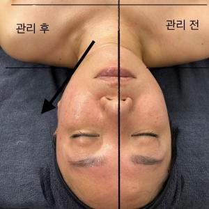 [경기/구리시] 엘더스파 (리프팅 관리)