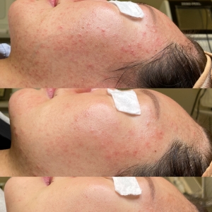 [경기/안양시] 언트에스테틱 ( 맞춤별 커스텀 케어 )