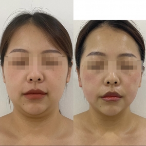 [부산/진구] 콤마에스테틱 (윤곽관리)