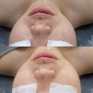 [인천/연수구] 티나 에스테틱 (수분관리 또는 아로마관리)