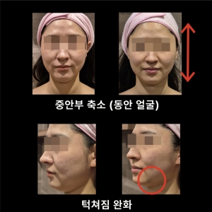 [경기/김포시] 피부예술