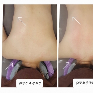 [전주/완산구] 윤결에스테틱 (드레스라인관리)