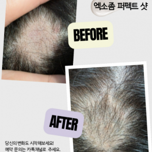 [서울/노원구] 에이오제이 (두피 탈모관리)